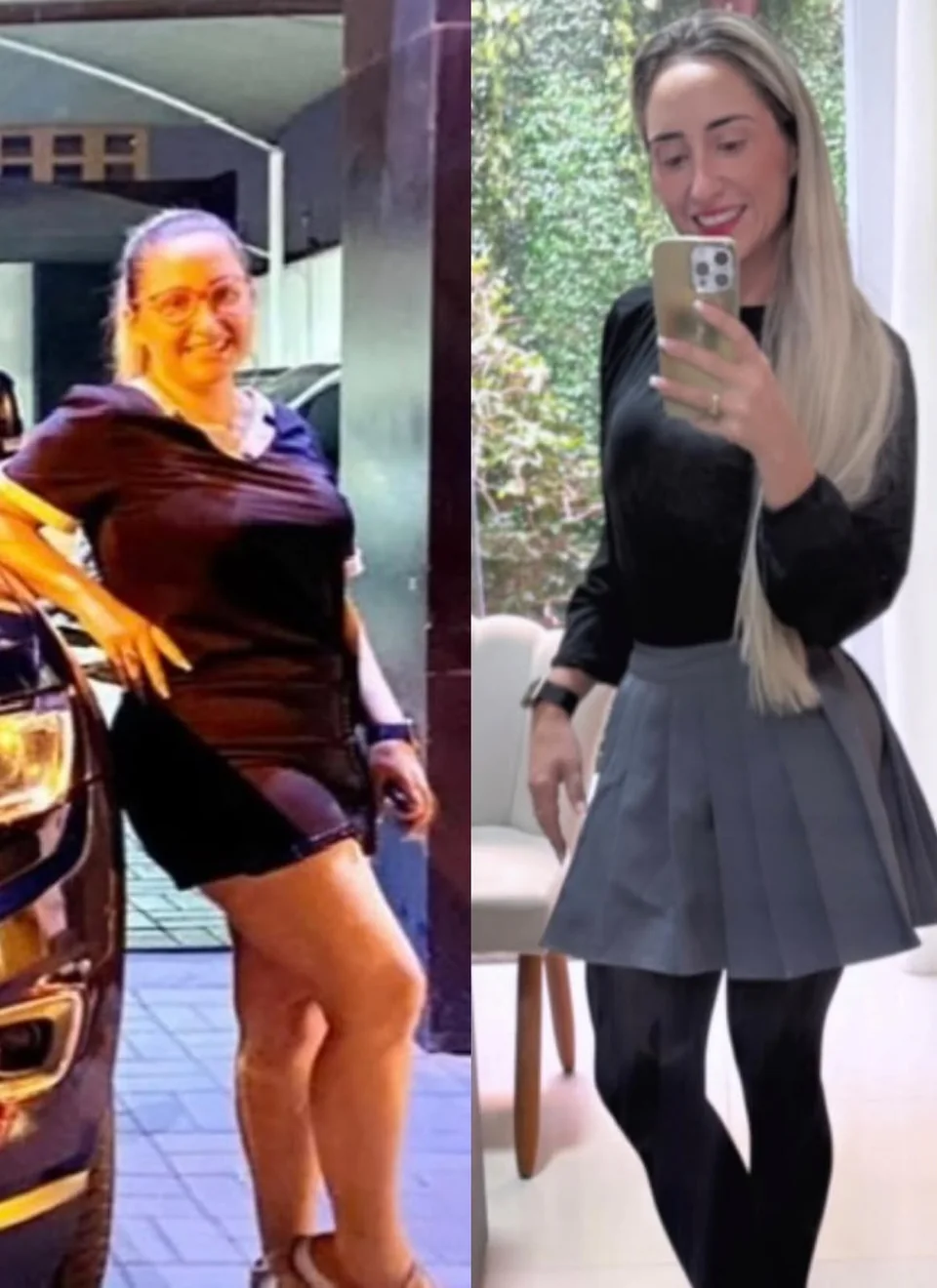 Evolução da Dra. Franciele Firmino - 40 kg eliminados